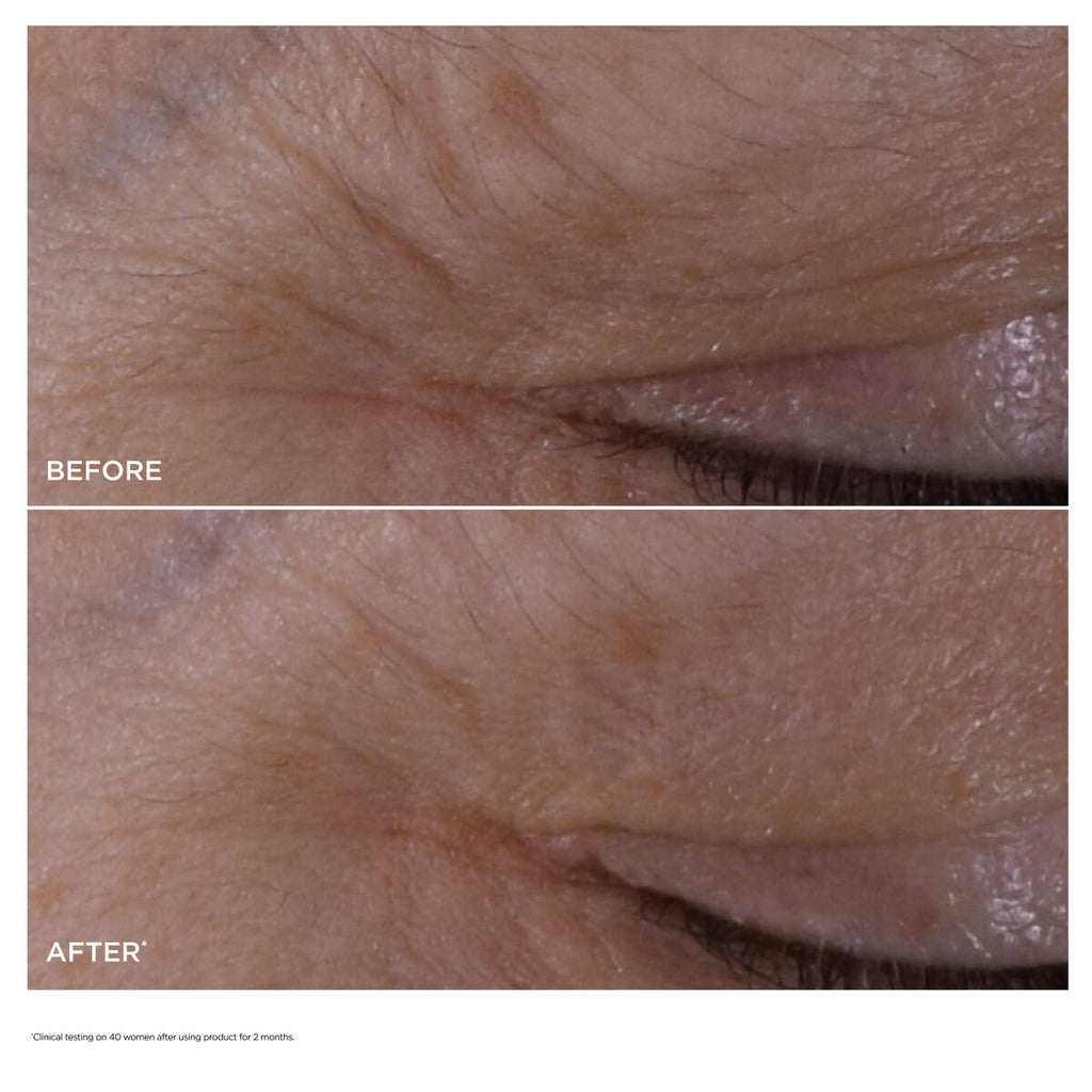 DOUBLE SERUM® Eye official gallery image C