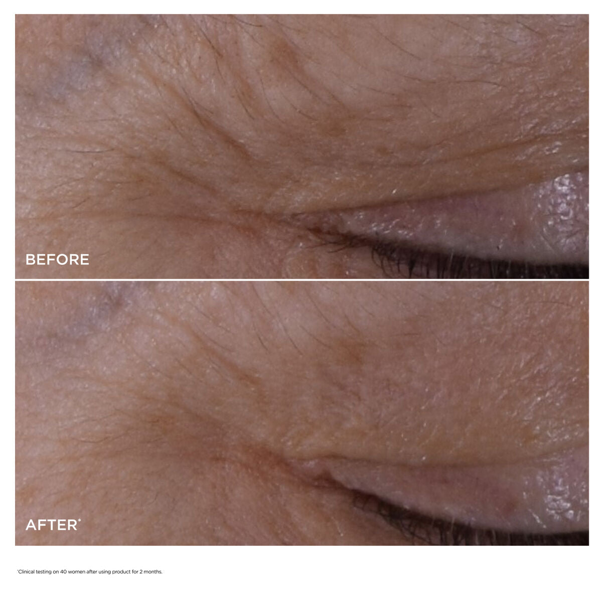 DOUBLE SERUM® Eye official gallery image C